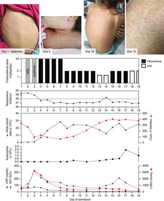 Case report: Drug reaction with eosinophilia and systemic symptoms (DRESS)-induced hemophagocytic disorder